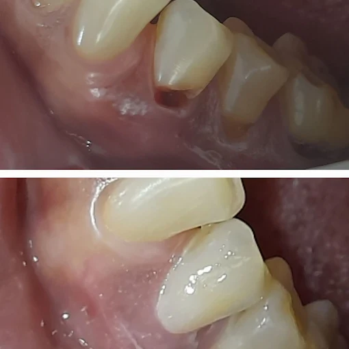 Pooja Smile Care Dental Gallery Image 28
